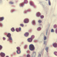 A photomicrograph of liver tissue infected by Cryptococcus.